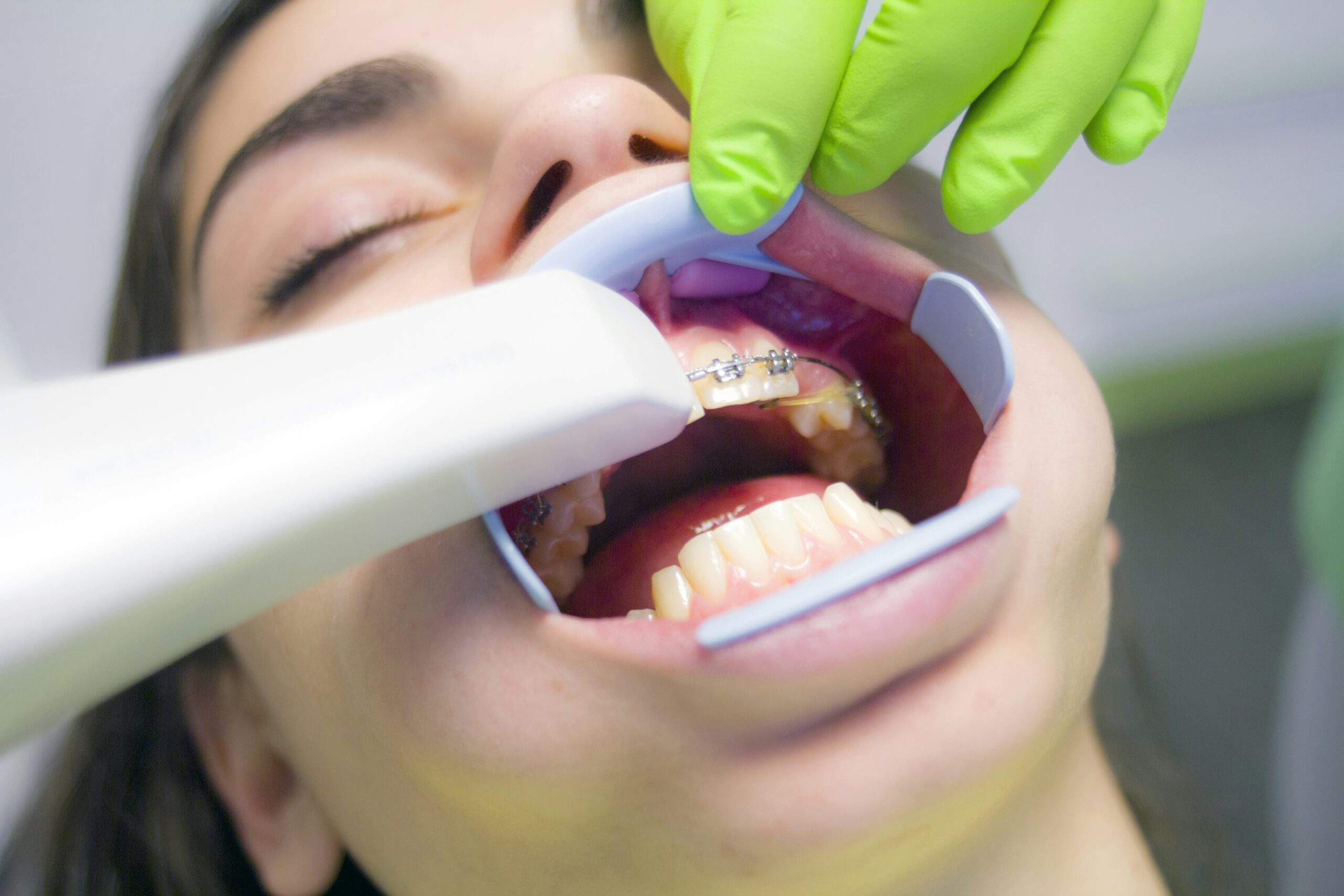 Scanning teeth at the local dentist